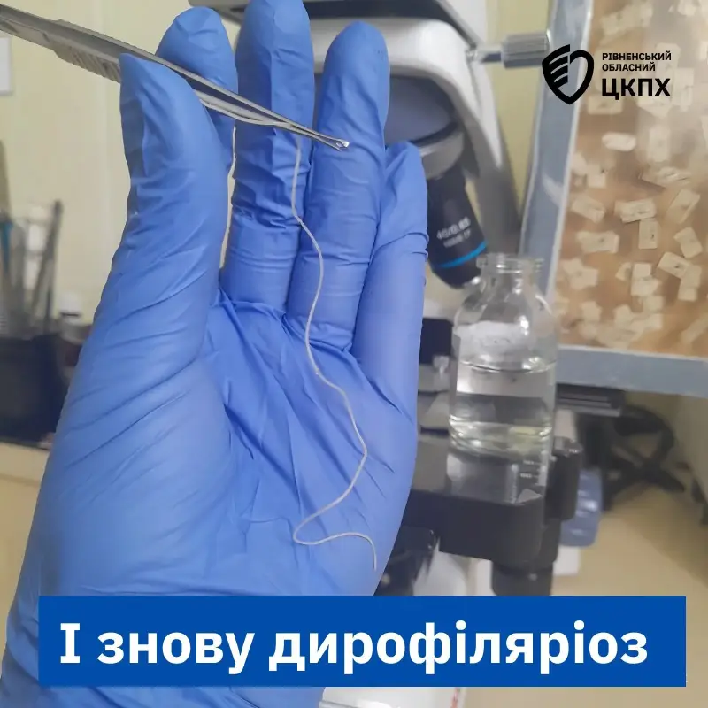 На Рівненщині жінці видалили 11-сантиметрового паразита з ока: як вберегтися від дирофіляріозу